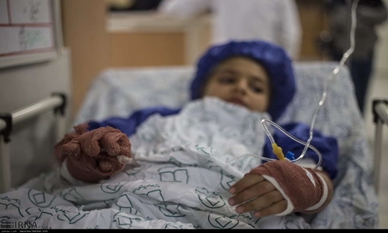 سوختگی؛ زخمی پنهان بر تن جامعه